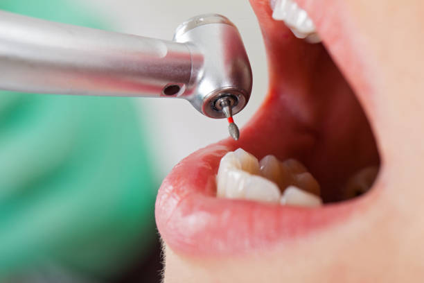 Best Knocked-Out Tooth Emergency  in Jonesboro, LA